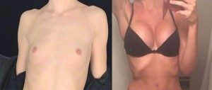 breasts