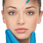 Cosmetic injection of botox