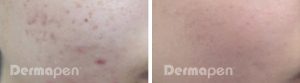 derma2