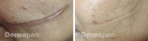 derma3