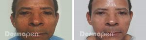 derma4