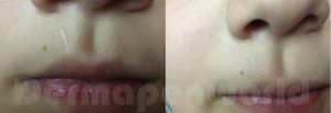 derma7