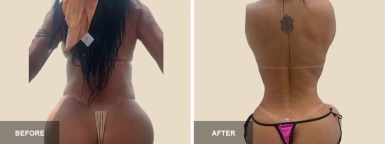 dr cucin lipo b a  x