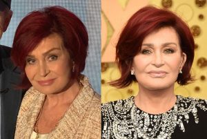 Sharon osbourne before and after x