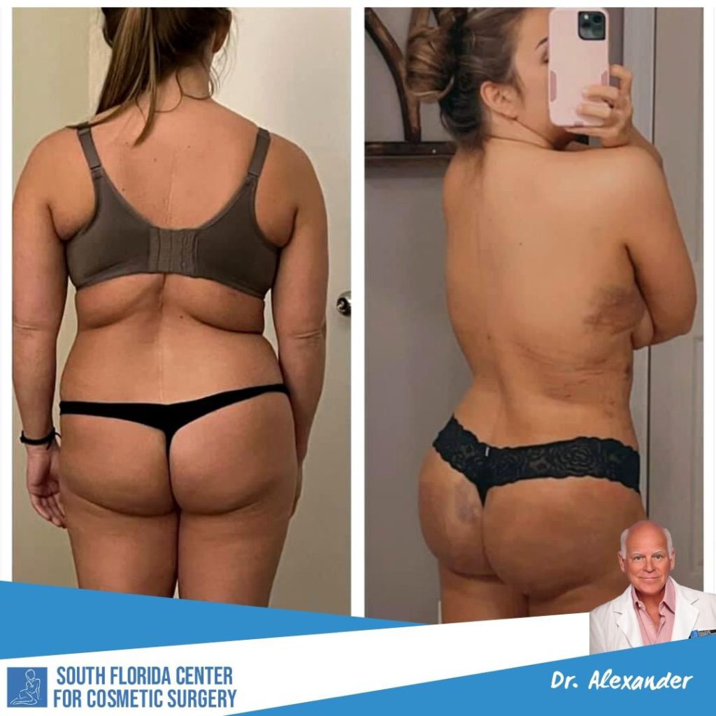 Dr. Shape’s Brazilian Butt Lift Pillow