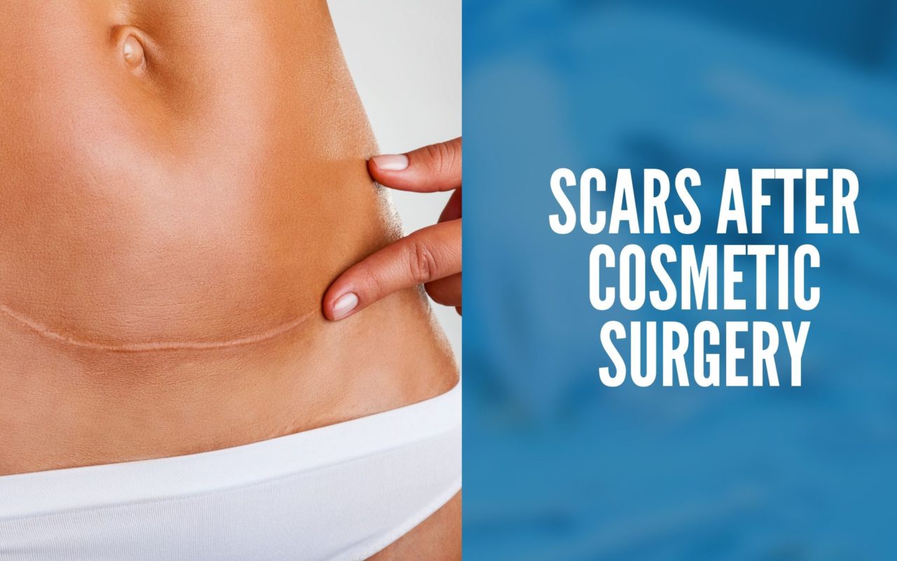 scars after cosmetic surgery