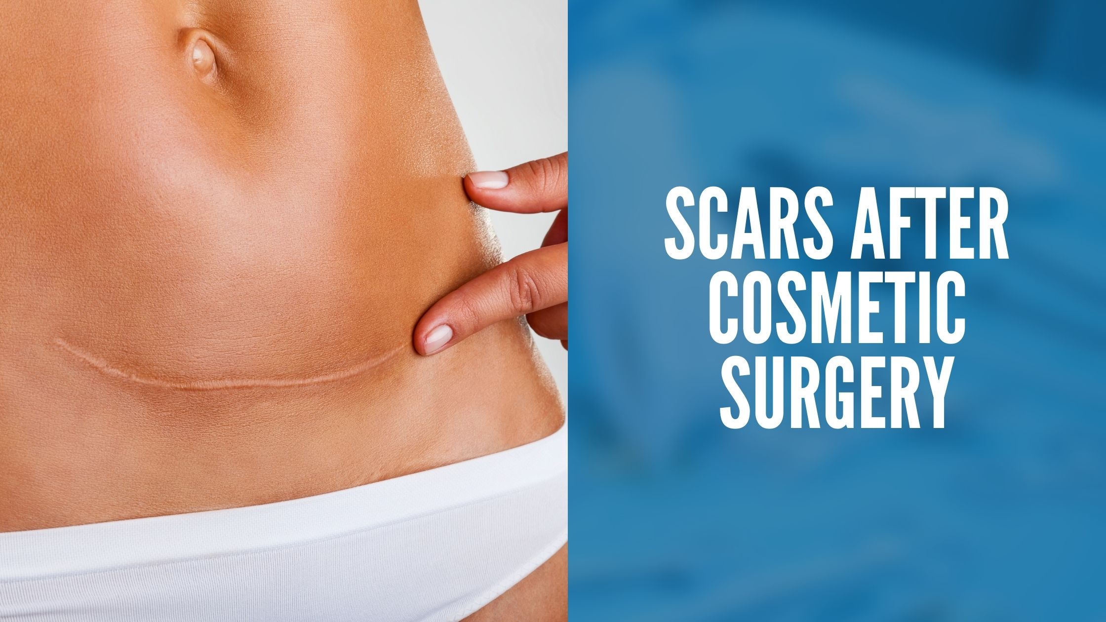 scars after cosmetic surgery