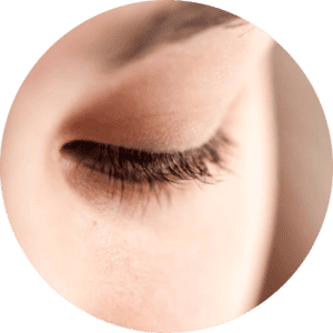 eyelids surgery x