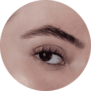 brow lift
