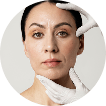 facelift 