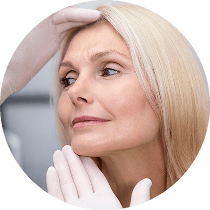 facelift 