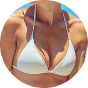 Breast augmentation