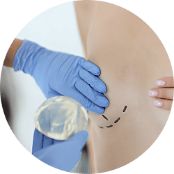 breast augmentation 