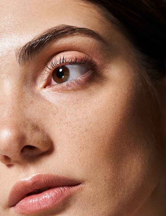 blepharoplasty  e