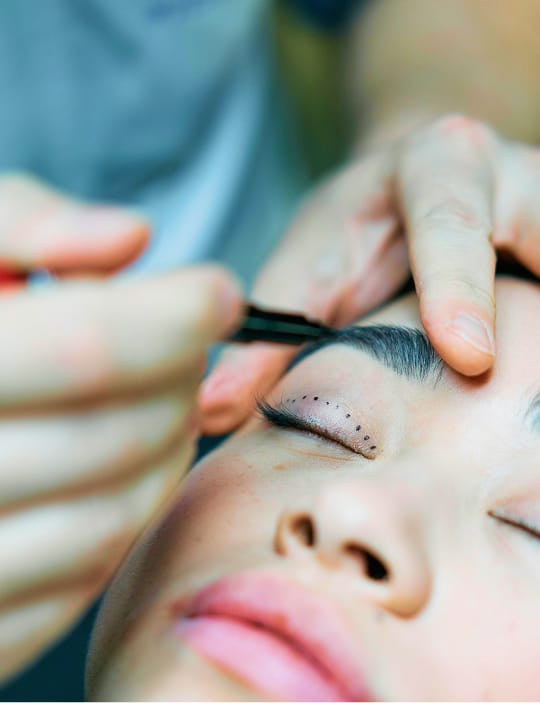 blepharoplasty 