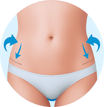 lipo 