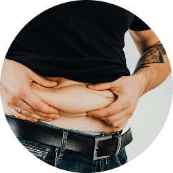 gynecomastia 