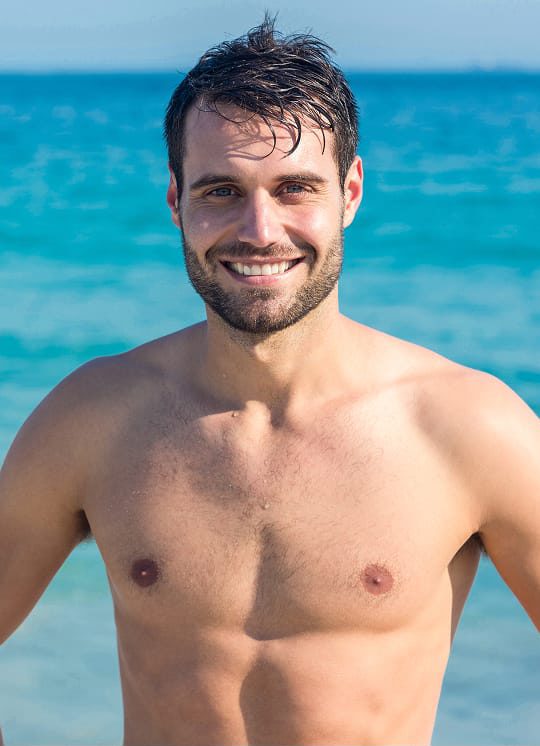 gynecomastia  e