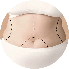 Lipo