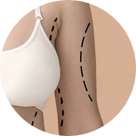 Lipo