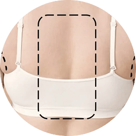 Lipo