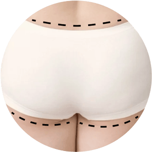 Lipo 