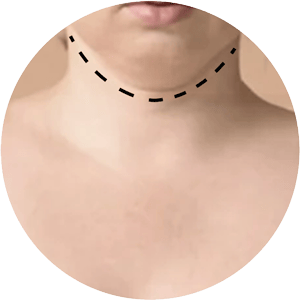 Lipo 