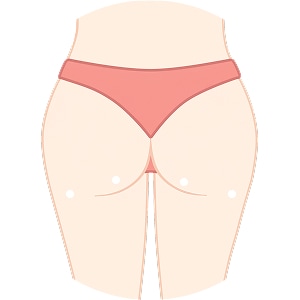 fat transfer