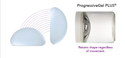 Screenshot 2025-11-18 110407 Motiva breast implants