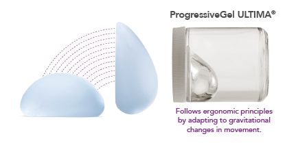 Screenshot 2025-11-18 110422 Motiva breast implants