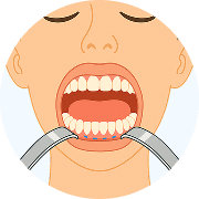 chin implant 
