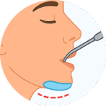 chin implant  x